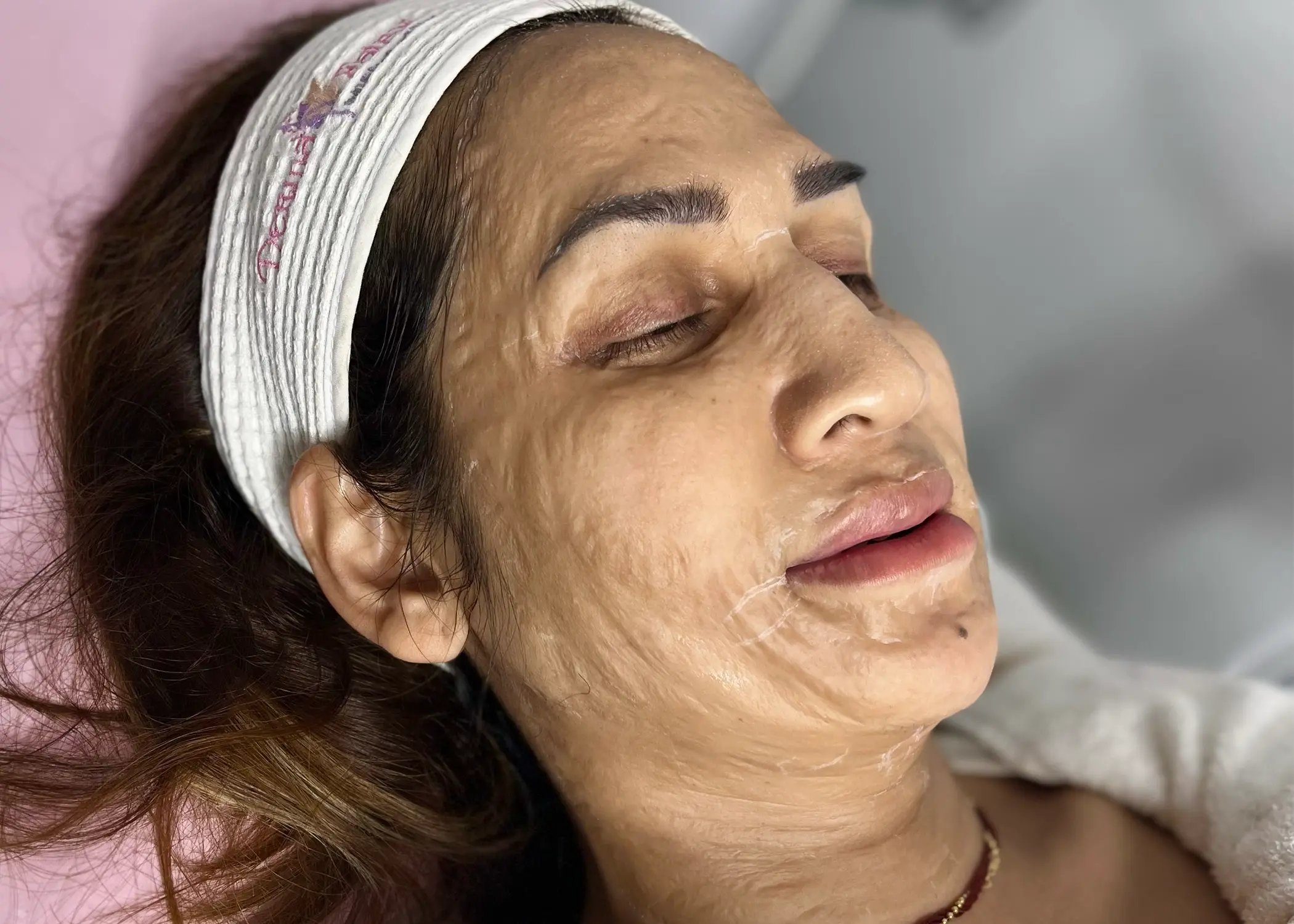 botox facail