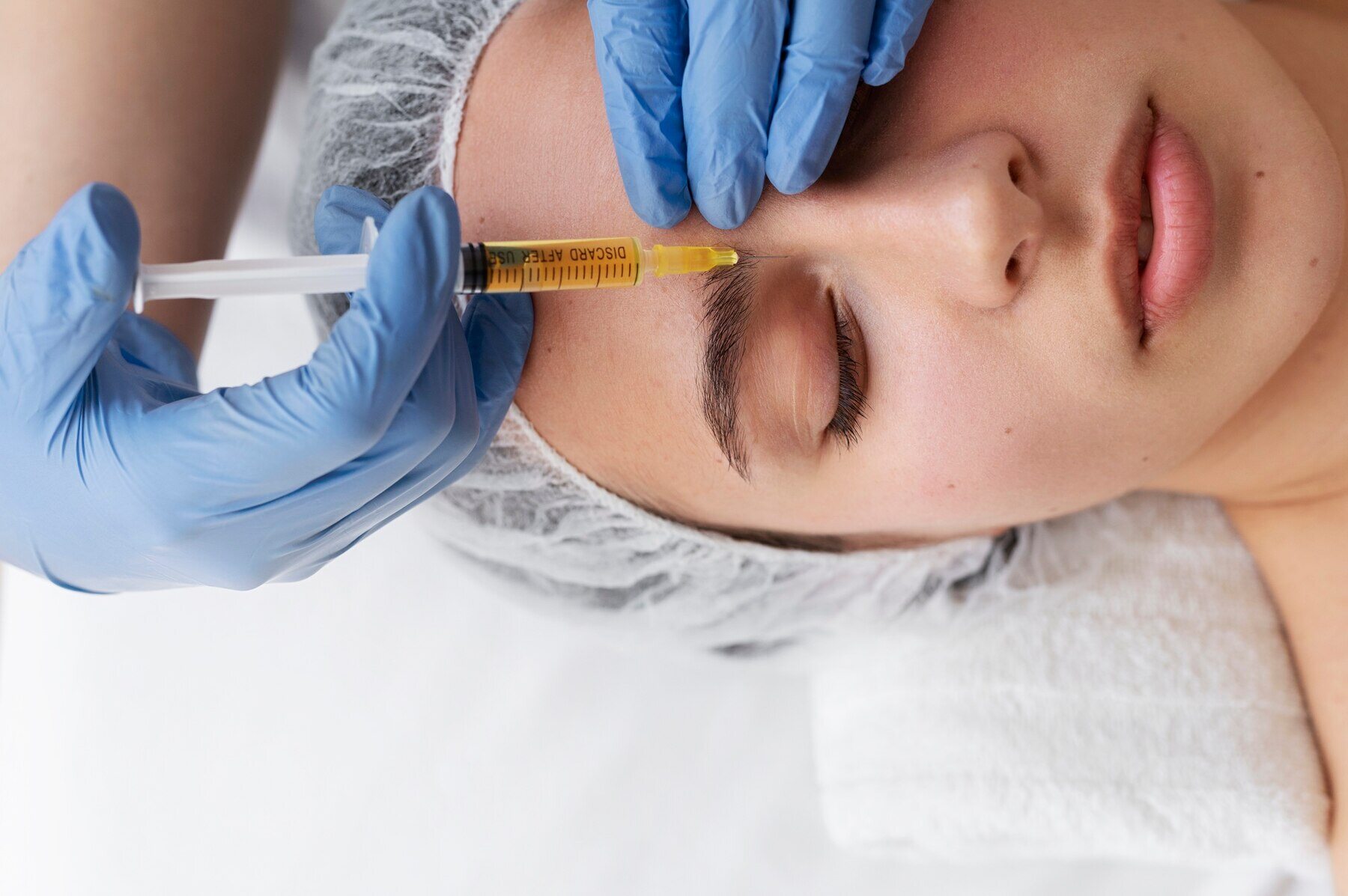 view-woman-getting-face-prp-treatment_23-2149404707